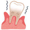 歯周病との深い関係